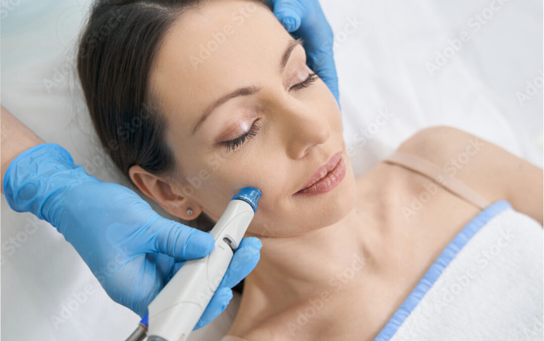 Why Hydrafacials Work Wonders for Your Skin